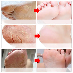 Exfoliating Foot Mask Spa Pedicure Socks Remove Dead Skin Whitening Feet Peeling Anti-Cracked Foot Skin Care